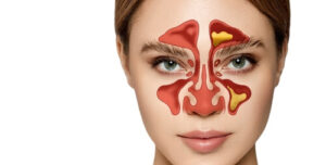 waking up with sinus headache